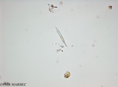 phyto/Thau_Lagoon/THAU_station1/OSU_plancton 2013/Calciosolenia murrayi (40x -140220)(copy)_thumb.jpg